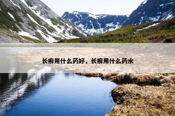 长癣用什么药好，长癣用什么药水