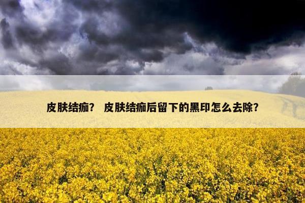 皮肤结痂？ 皮肤结痂后留下的黑印怎么去除？